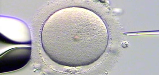 IVF. АльтраГен